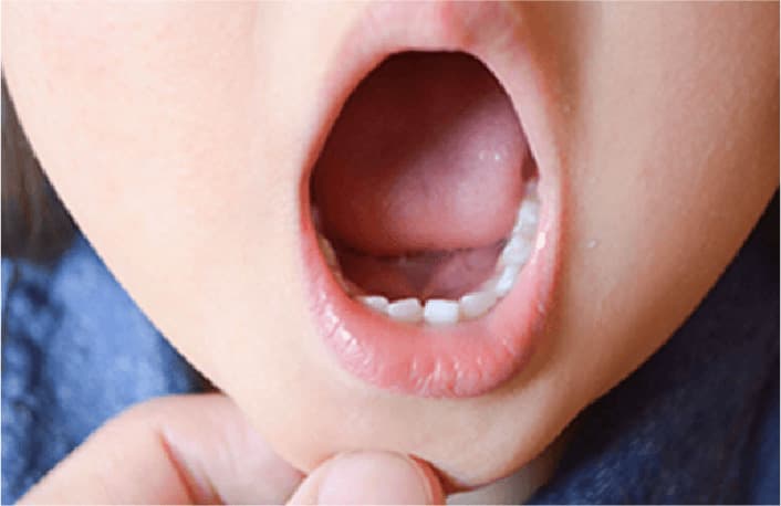 口がポカンと開いている、口で息をしている