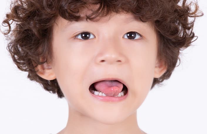 ことばがはっきりしにくい音がある